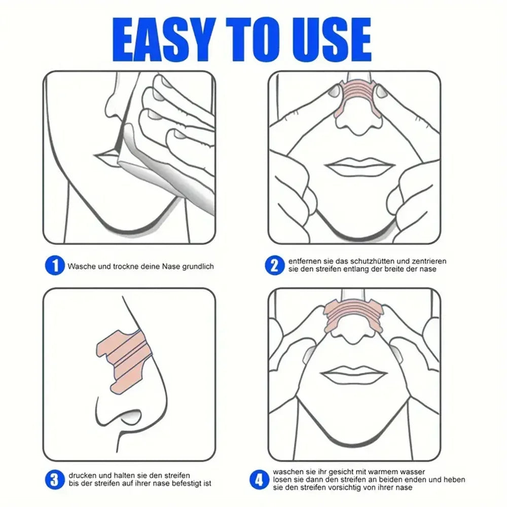 Bandelettes Nasales Anti-Ronflement - Respiration Facilitée